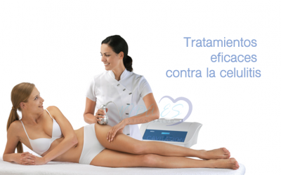 Tratamientos eficaces contra la celulitis